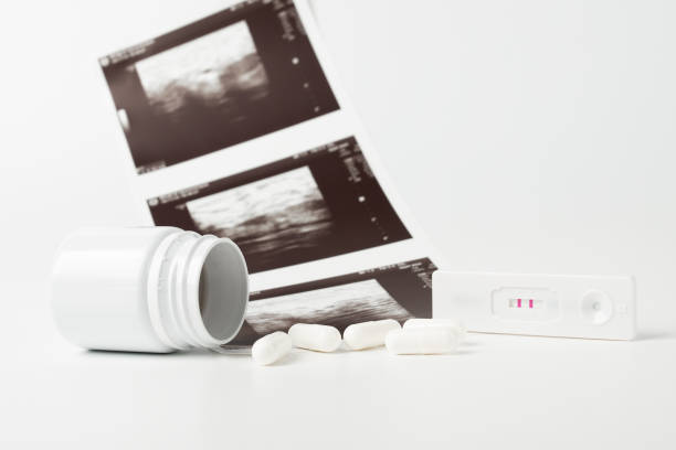 Understanding Abortion Consultations Information, Questions, and Support